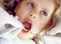 Что необходимо знать о пломбировании зубов