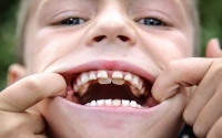 Семь удивительных фактов о зубах