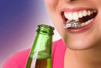 Привычки, которые могут навредить зубам