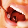 Протезирование зубов инвалидам на дому