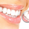 Как укрепить зубы?