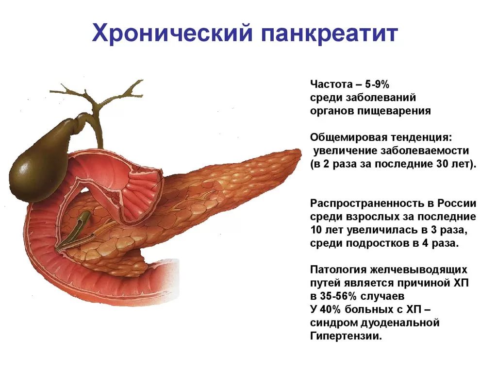 панкреатит. признаки и лечение.