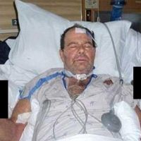 Спасение кошки закончилось для сварщика комой и ампутацией пальцев