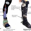 Мягкий экзоскелет поможет больным с параличом конечностей