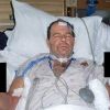 Спасение кошки закончилось для сварщика комой и ампутацией пальцев