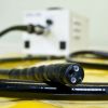 Врачи чуть не убили пациентку, изучая ее желудок