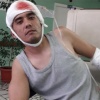 «Решили, что со мной всё хорошо»: в Уфе не дают инвалидность мужчине, пережившему две трепанации черепа