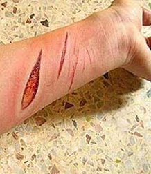 О ранах, швах и нитках…